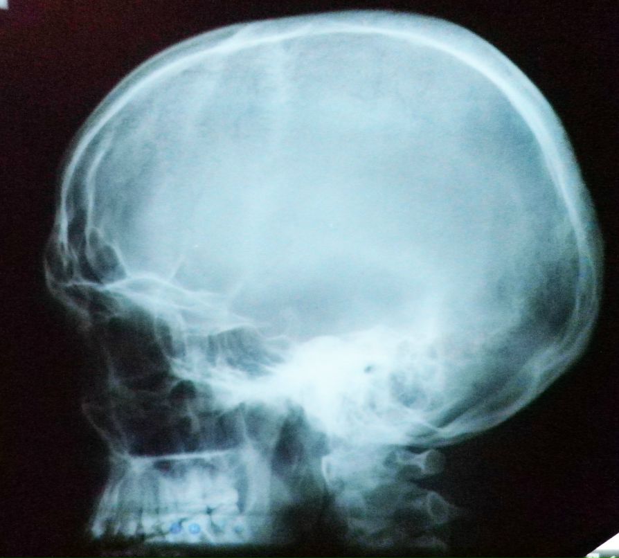 Дмитрий Ляшко фотография #16