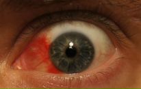 Фотография Ремизова Вячеслава